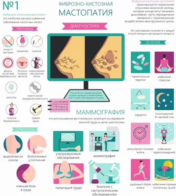 МАСТОПАТИЯ - ОДНО ИЗ ПРЕДРАКОВЫХ ЗАБОЛЕВАНИЙ МОЛОЧНЫХ ЖЕЛЕЗ - ГБУЗ ЯНАО