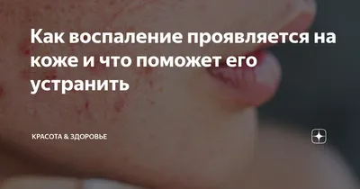 Воспаление на лице человека, …» — создано в Шедевруме