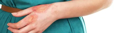 Боль в суставе большого пальца на руке: причины и способы лечения,  особенности боли при сгибании и заболевания пальца