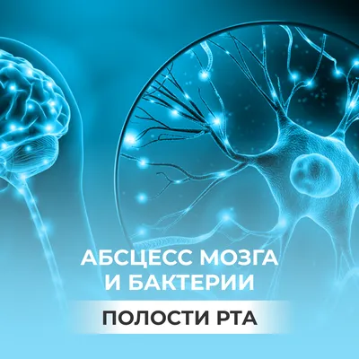 Паратонзиллярный абсцесс: причины, методы лечения, принципы профилактики |  ЛОР Кабинет