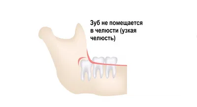 Частично съемный зубной протез на верхнюю и нижнюю челюсть, цена 9900р