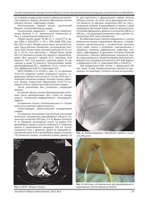 Случай пункционного метода лечения абсцесса печени при деструктивном  аппендиците, осложненном пилефлебитом