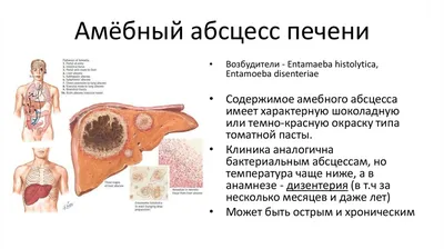 Абсцесс печени: причины, классификация, симптомы, диагностика, лечение,  диета, осложнения, последствия