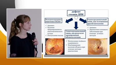 Медіком Кривбас - 🤔🤔🤔Слово «гепатит» — переводе с греческого значит,  «воспаление печени». 🔔 «Тихим убийцей» называют наиболее распространенную  форму недуга — вирусный гепатит B (Б). По статистике, ежегодно в мире от  него