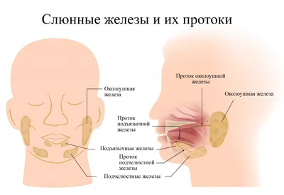 Рис. 1. Разрастание аденокарциномы мейбомиевой железы на конъюнктиве в…