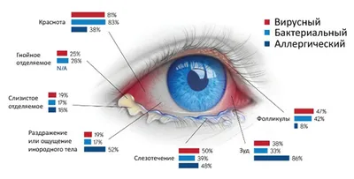 Покраснение глаз при конъюнктивите - энциклопедия Ochkov.net