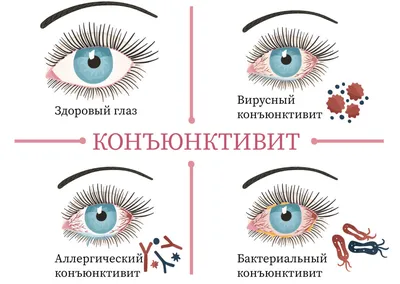 Аденовирусная инфекция: симптомы и лечение у детей и взрослых