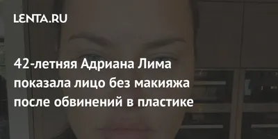 Лицо уставшей мамы»: Адриана Лима опровергает обвинения в пластике (но ей  все равно не верят)