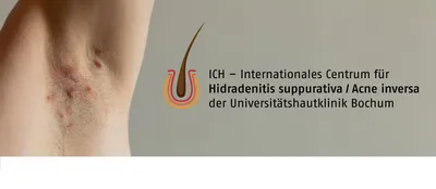 Centrum für Hidradenitis suppurativa / Acne inversa (ICH) - Katholisches  Klinikum Bochum