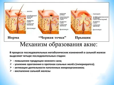 Лечение акне (угревая сыпь) на лице у мужчин и женщин цена в Москве