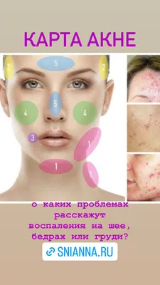 Как избавиться от акне - советы врачей в Киеве из Coolaser Clinic