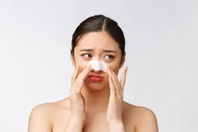 Прыщи в области носа? Лучшие советы дерматологов США | Красота спасет мир |  Дзен