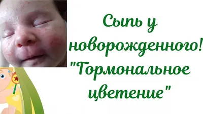 Акне у новорожденных на лице: фото, до какого возраста, что делать