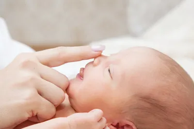закрывание кожицы лица младенца прыщами и акне от дерматита. Стоковое Фото  - изображение насчитывающей медицинско, малыш: 256904928