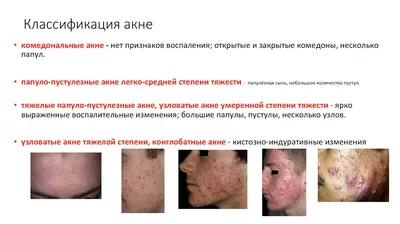 Областной кожно-венерологический диспансер г. Липецка