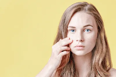 Лечение угревой сыпи в Оренбурге - Лечение угревой сыпи - Красота: 10  косметологов со средним рейтингом 5.0 с отзывами и ценами на Яндекс Услугах