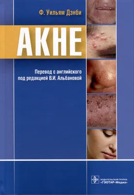 How to Recognize What Kind of Acne You Have | Innate Skin | Types of acne,  Skin care acne, Skin treatments