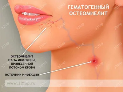 Грибок кожи: диагностика, лечение, препараты и мази