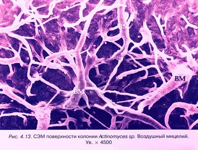 Грибковый блефарит — симптомы - энциклопедия Ochkov.net