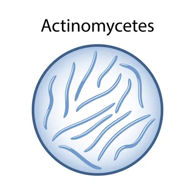 Актиномикоз бронхов и легких Actinomycosis of the lungs and bronchi