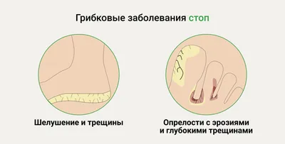 Актиномикоз кожи и подкожной клетчатки – тема научной статьи по  ветеринарным наукам читайте бесплатно текст научно-исследовательской работы  в электронной библиотеке КиберЛенинка