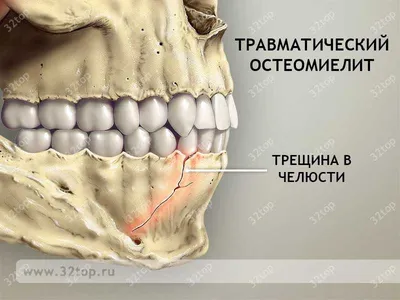 Травяная мазь \"Король кожи\" (id 40515970), купить в Казахстане, цена на  Satu.kz