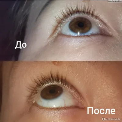 Алерана для ресниц фото до и после фото