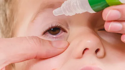 набор красноватый глаз аллергия конъюнктивит рыба насморк лекарства бутылка  и таблетки ингалятор медицинский цифровой Иллюстрация вектора - иллюстрации  насчитывающей здоровье, зрачок: 227188766