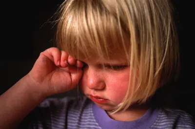 Аллергический коньюктивит. Как победить??? — 34 ответов | форум Babyblog