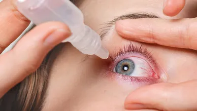 Виды глазной аллергии - полезные статьи от «Доступной среды»