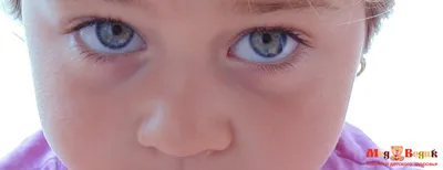Красные глаза у ребенка | Детское Зрение | Дзен