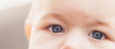 глаз ребенка с воспалением конъюнктивита. Стоковое Фото - изображение  насчитывающей микстура, бекона: 261368374