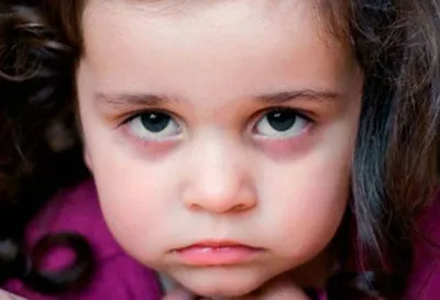 Аллергия у детей: на что бывает, основные аллергены у детей — Fenkarol®