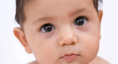 Что делать, если у ребенка «синяки» под глазами: почему возникают темные  круги? | О детском здоровье: с врачебного на родительский | Дзен