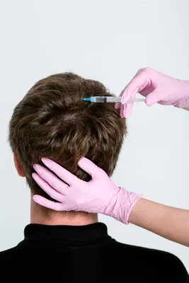 Лечение волос и кожи головы - Клиника омоложения Intellihealth Plus