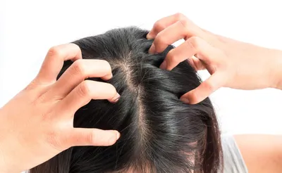 Шампунь Siberina 100% натуральный Восстанавливающий - «Аллергия, зуд,  дерматит кожи головы- это не про натуральный шампунь. Чистые волосы без  вреда для кожи головы. » | отзывы