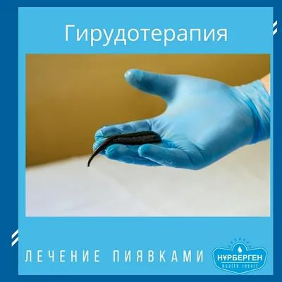Варикозный дерматит - статьи медицинского центра доктора Бегмы в Москве