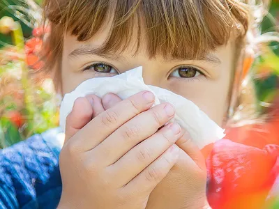 Аллергия у ребенка: как понять, что она началась, и можно ли от нее  избавиться - KP.RU