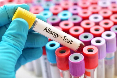 Как лечить грипп и ОРВИ у ребенка с аллергией, можно ли принимать Цитовир-3  - 7 октября 2019 - nn.ru
