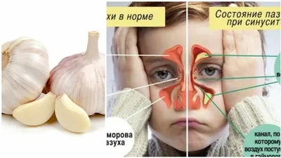 Колики у новорожденных: симптомы, причины, отличия от газиков, лечение, как  помочь ребенку