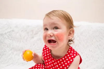 Сыпь у ребенка Ребёнку 9 месяцев, по всему телу, в основном на лице,  животике | MedAboutMe