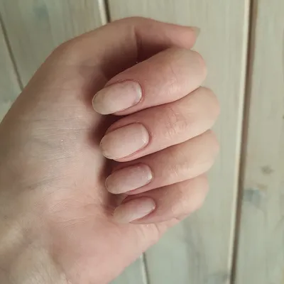 Аллергия - не приговор! | lianna_nails | Дзен