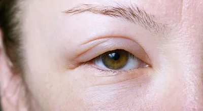 Средства для лечения аллергии Фармак Лоратадин - «Спасти косметического  маньяка... Лоратадин как SOS-средство при аллергии на патчи для кожи вокруг  глаз» | отзывы