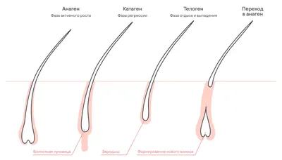 Облысение у женщин | Как вылечить алопецию у женщин - клиника Алтеро