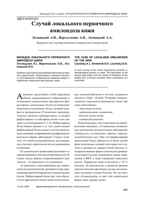 Амилоидоз почек - Заболевания, ненасильственная смерть - Судебная медицина  от Forens.ru