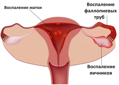 МЕХАНИЗМЫ ЗАЩИТЫ ПОЛОВОЙ СИСТЕМЫ — Гинекологический кабинет О.В. Кичигина —  Сигма-Мед Калининград.