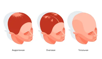 Лазерное лечение кожи головы ResurHair | Premium Aesthetics