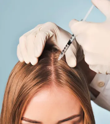 Алопеции - все виды это заболевания волос | Трихолог - Винница