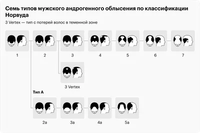 У меня сильно выпадают волосы. Это плохо? | Купрум