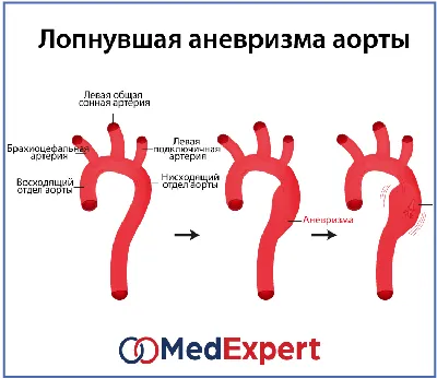 Медицинские статьи на сайте компании Эндомедис